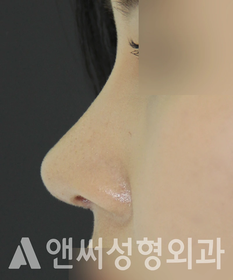 Answer Plastic Surgery case 492: After