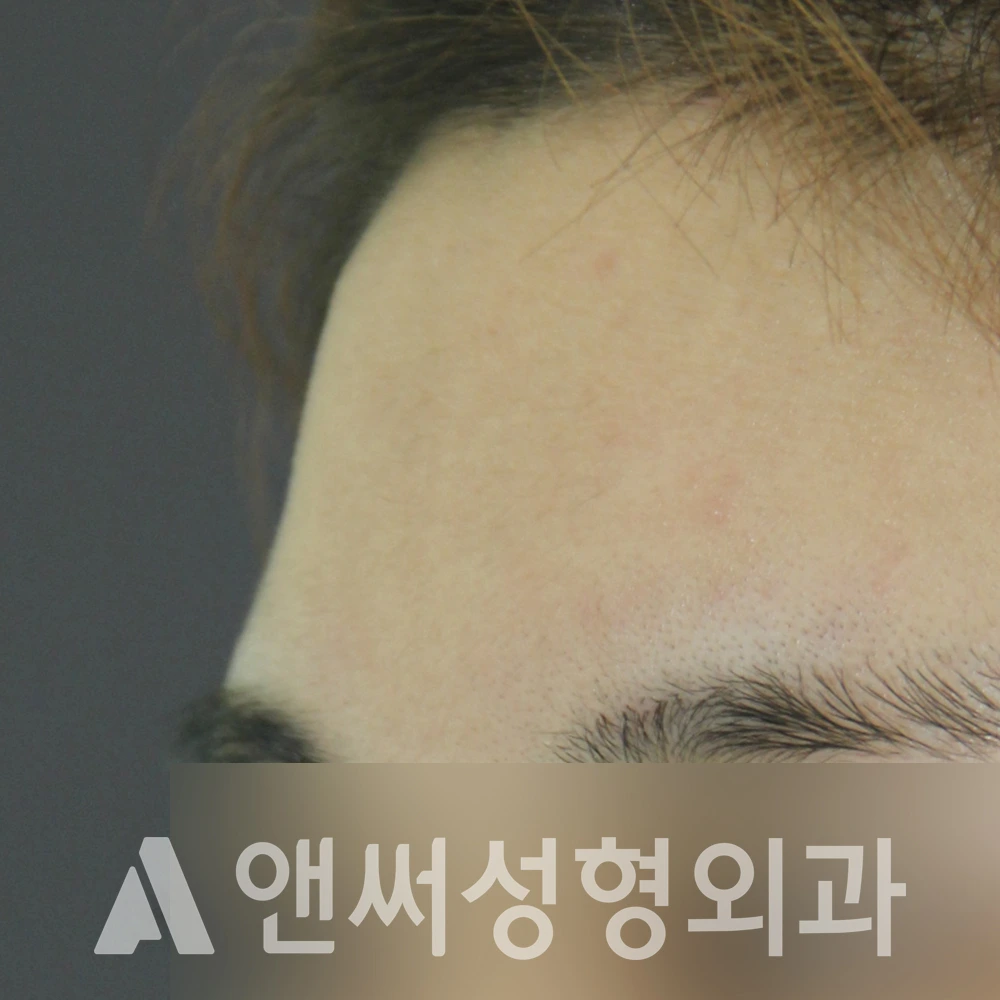 Answer Plastic Surgery case 491: Before