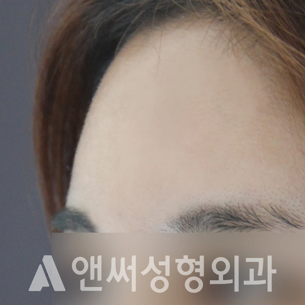 Answer Plastic Surgery case 491: After