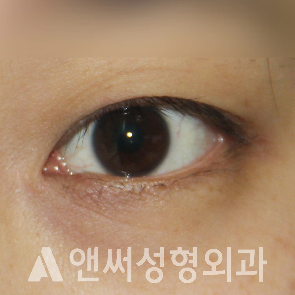 Answer Plastic Surgery case 490: Before
