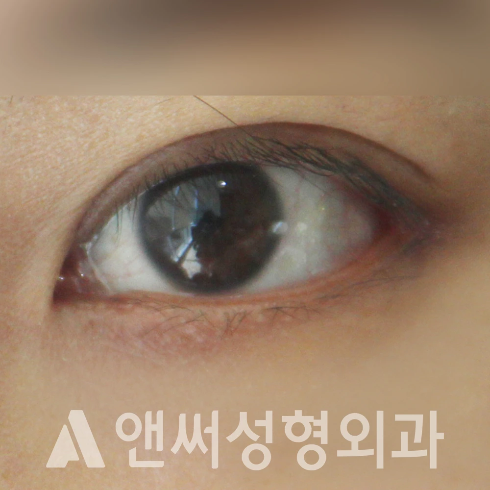 Answer Plastic Surgery case 490: After