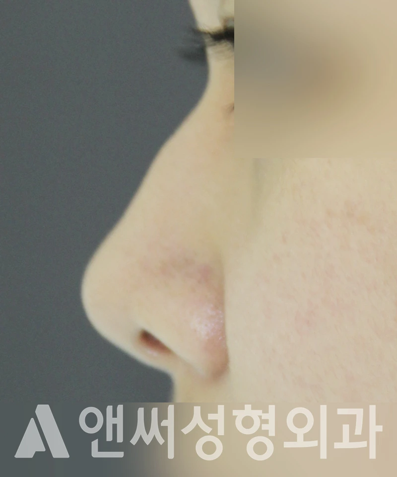 Answer Plastic Surgery case 489: Before