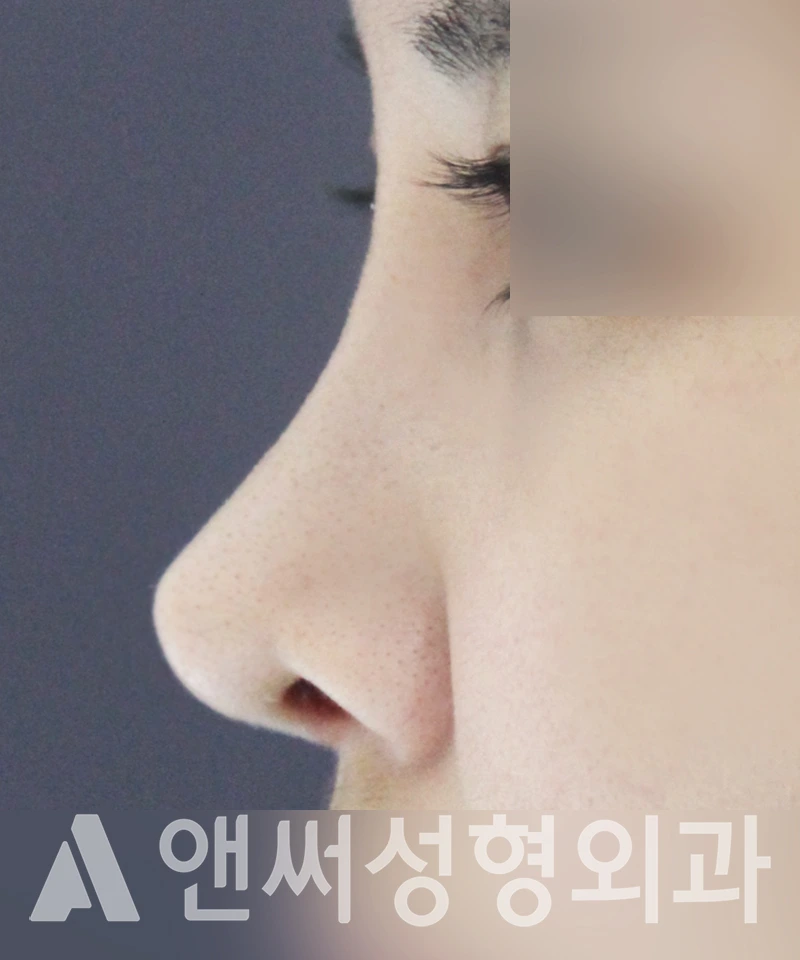 Answer Plastic Surgery case 489: After