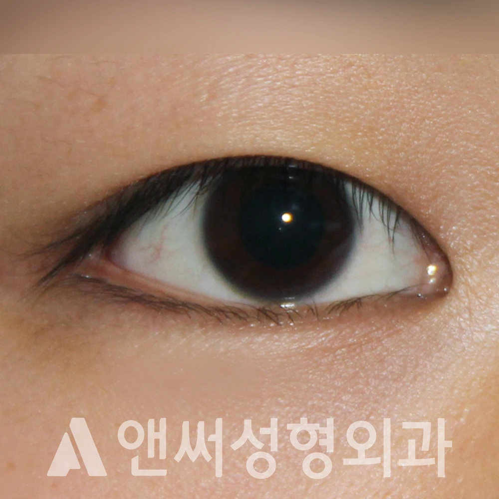 Answer Plastic Surgery case 486: Before