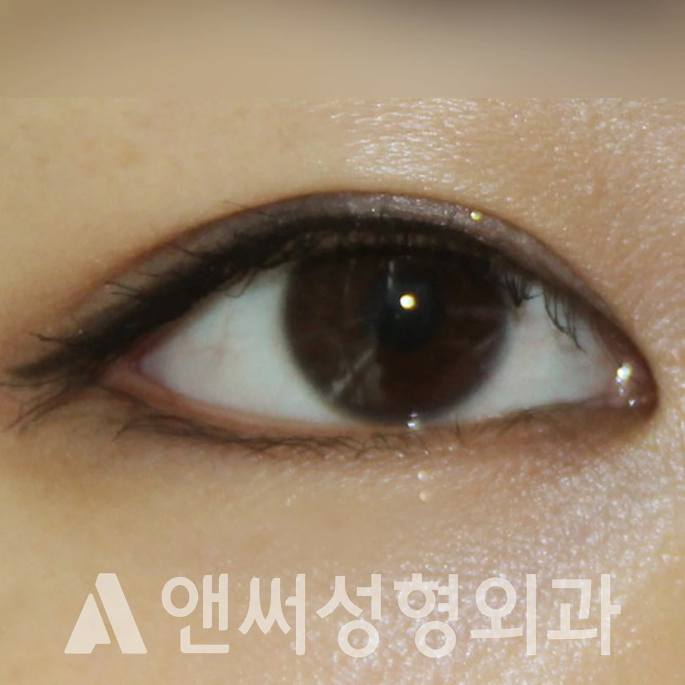 Answer Plastic Surgery case 486: After