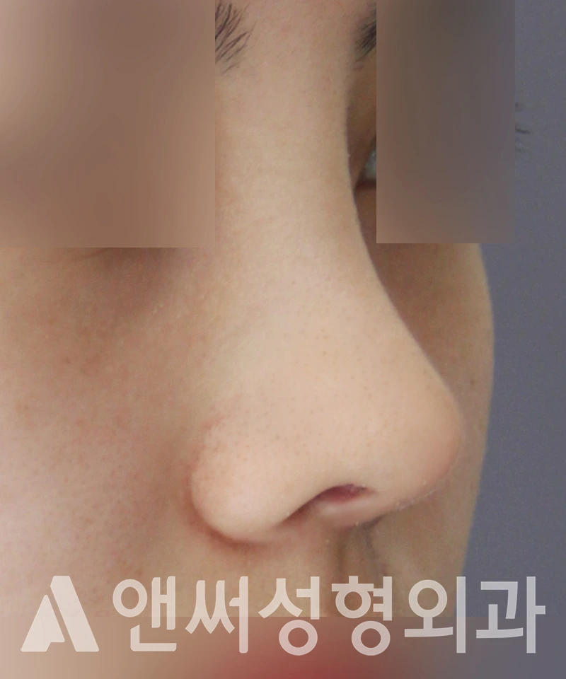 Answer Plastic Surgery case 484: After