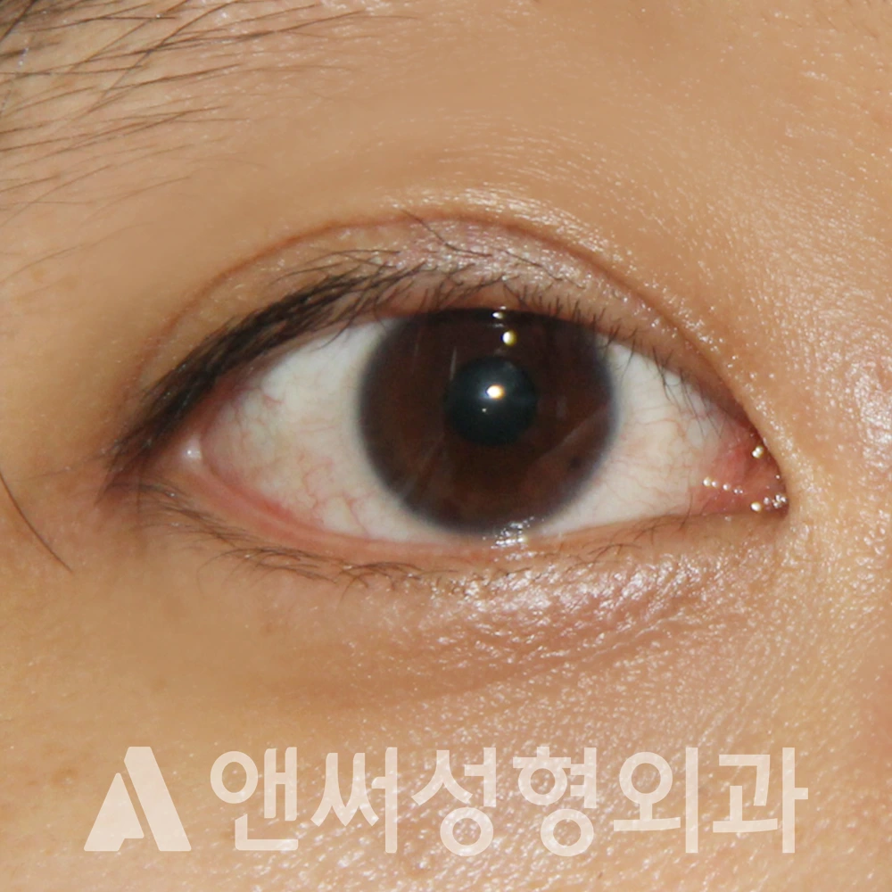 Answer Plastic Surgery case 483: After