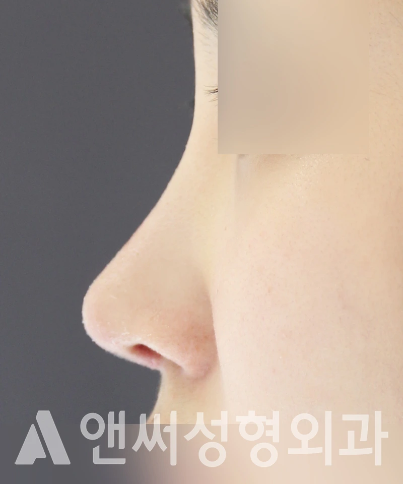 Answer Plastic Surgery case 482: After