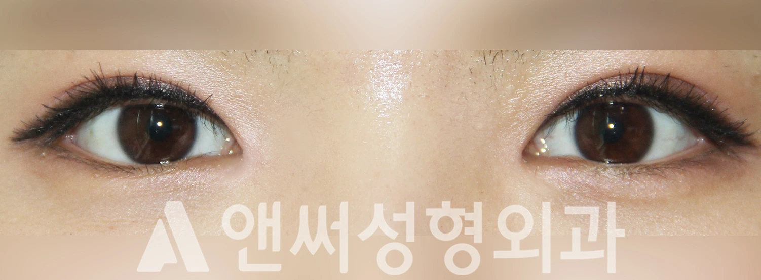 Answer Plastic Surgery case 481: After