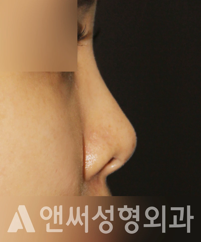 Answer Plastic Surgery case 456: Before