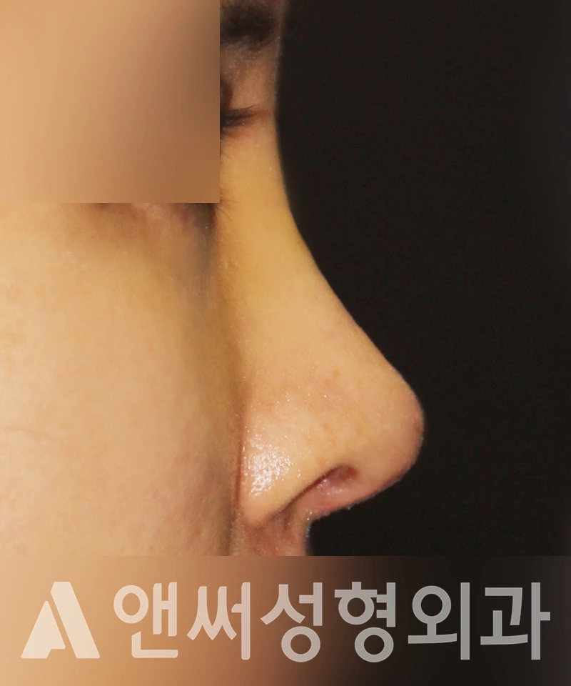 Answer Plastic Surgery case 456: After