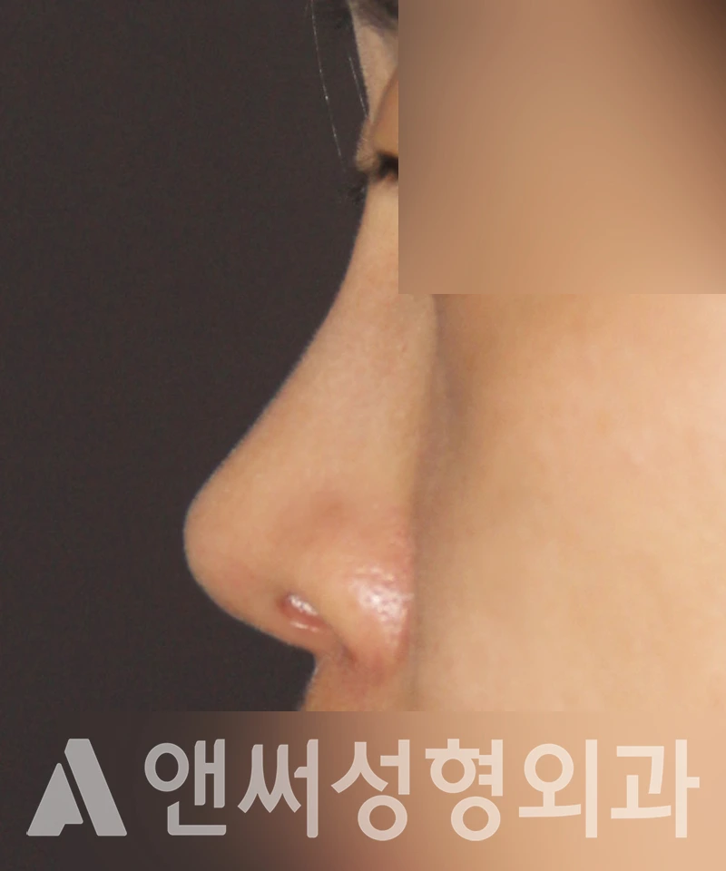Answer Plastic Surgery case 455: After