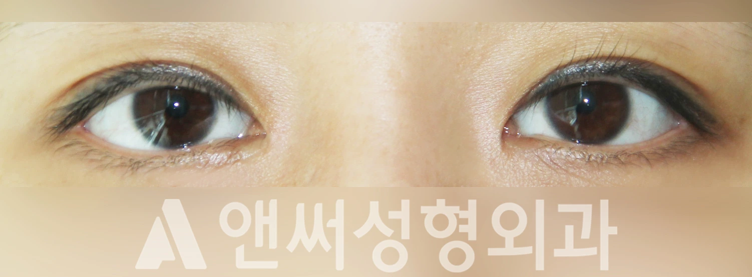 Answer Plastic Surgery case 454: After