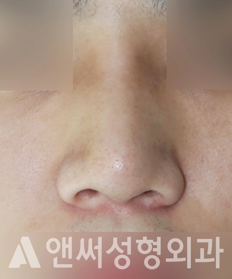 Answer Plastic Surgery case 453: After