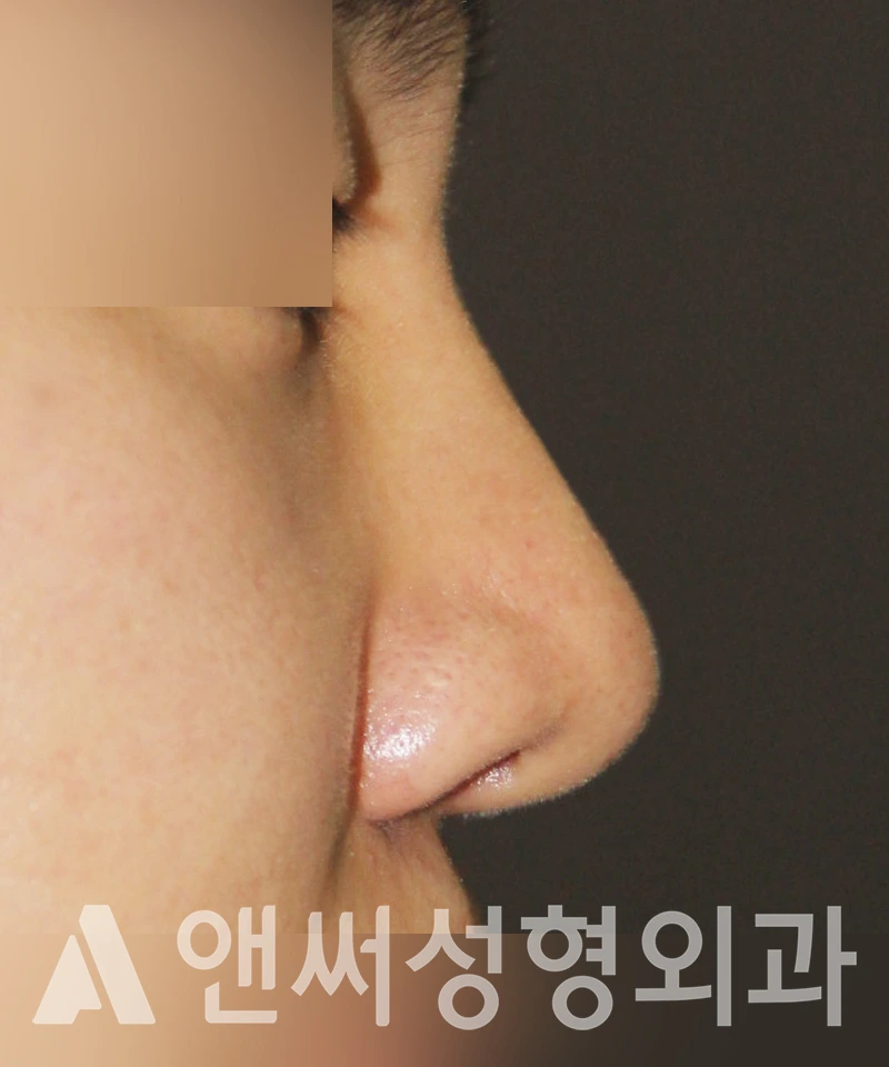 Answer Plastic Surgery case 452: After