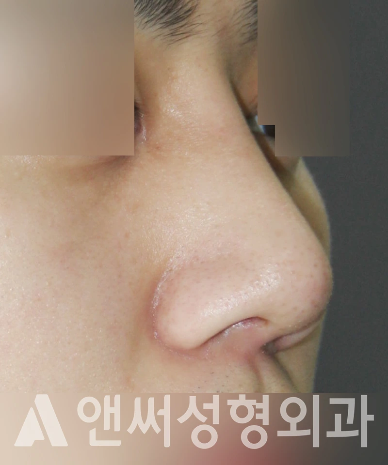 Answer Plastic Surgery case 450: After