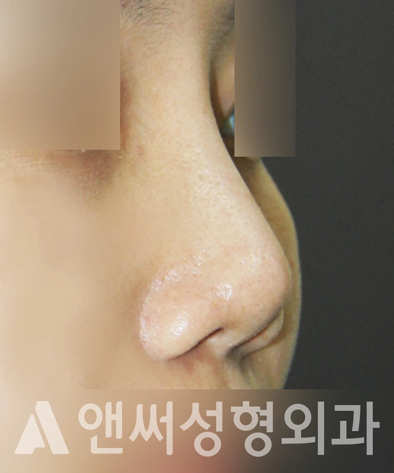 Answer Plastic Surgery case 449: Before