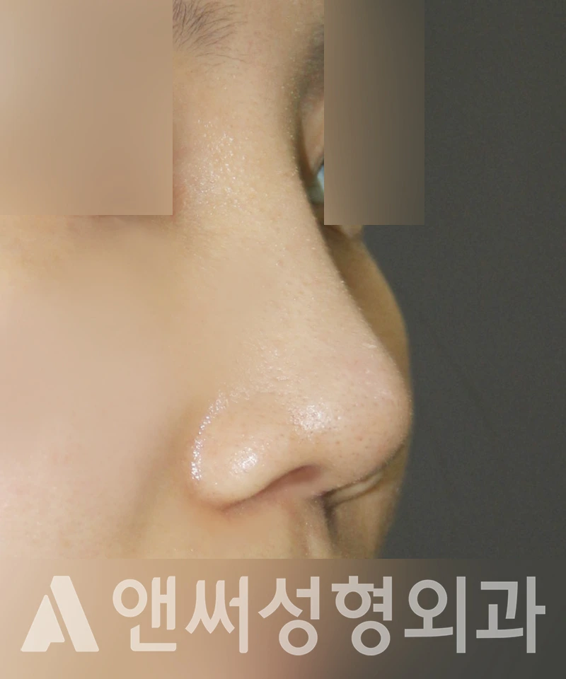 Answer Plastic Surgery case 449: After