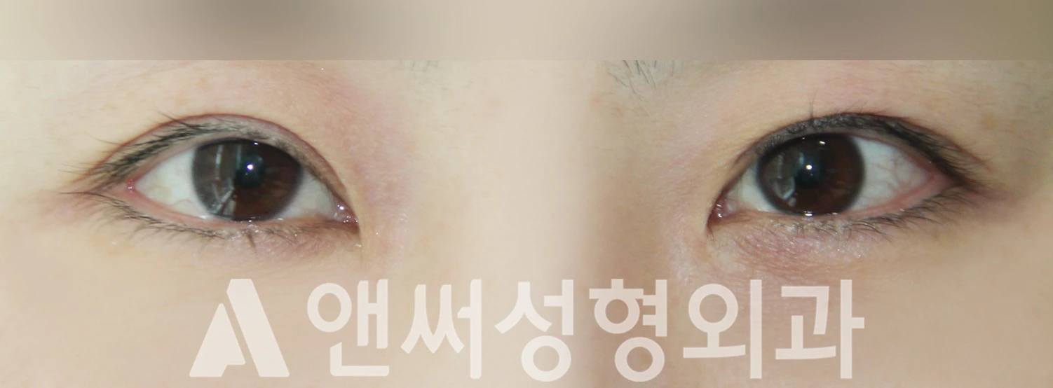 Answer Plastic Surgery case 448: After
