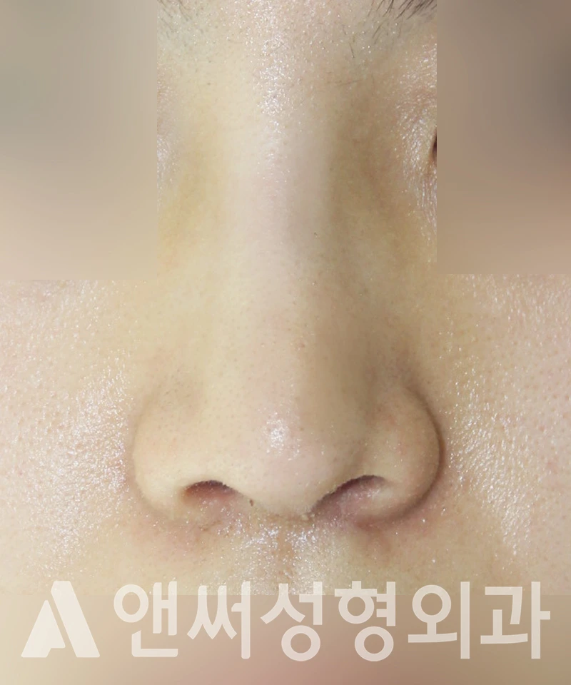 Answer Plastic Surgery case 447: After