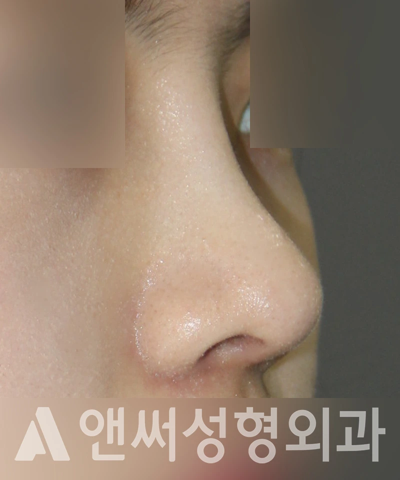 Answer Plastic Surgery case 445: After