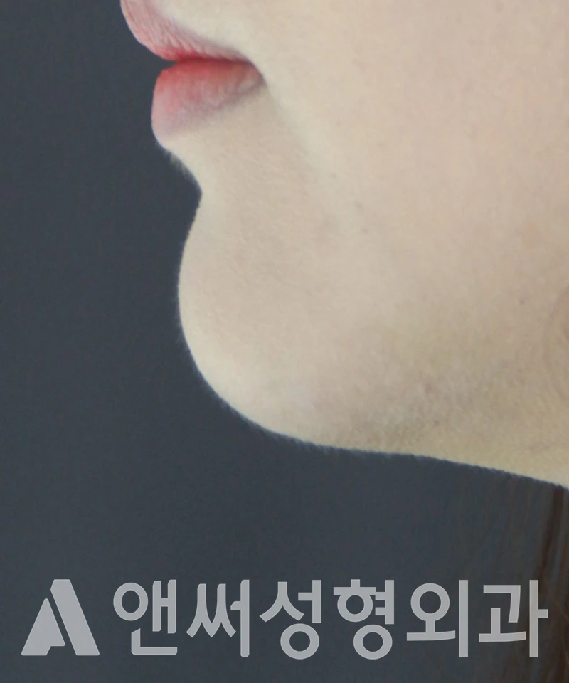 Answer Plastic Surgery case 444: After