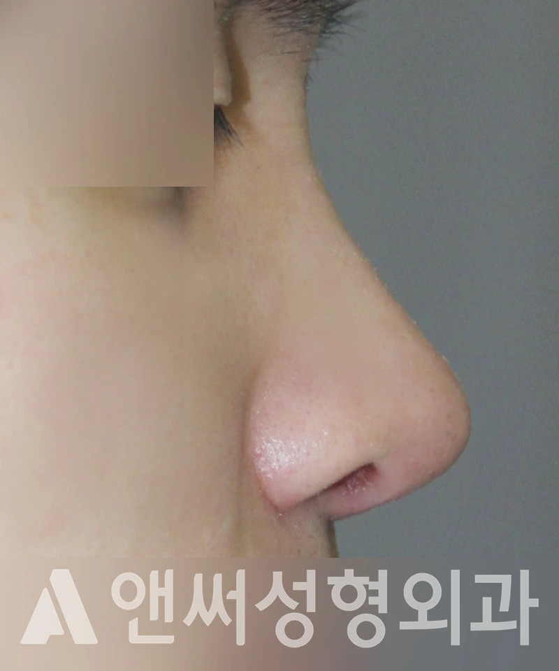 Answer Plastic Surgery case 443: After