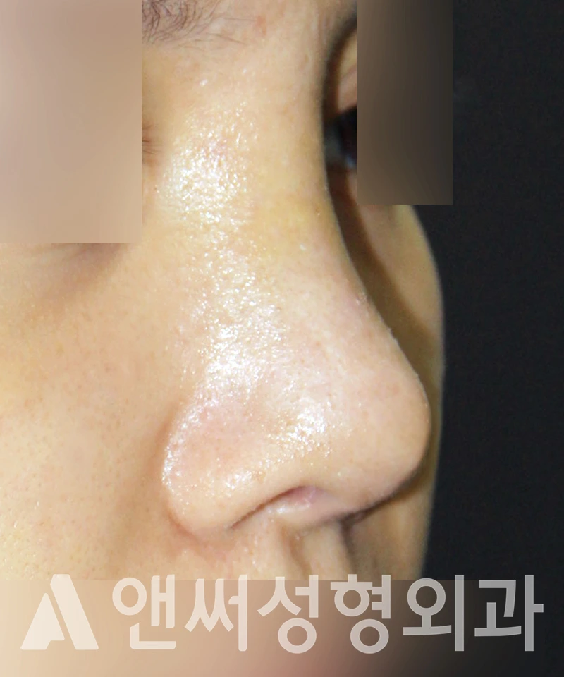 Answer Plastic Surgery case 442: After