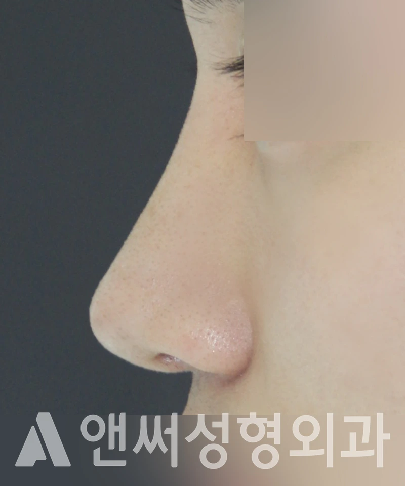Answer Plastic Surgery case 441: After