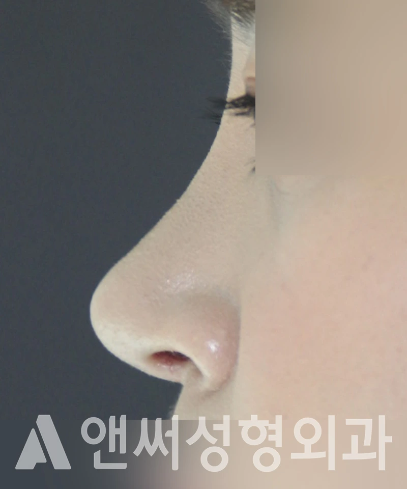 Answer Plastic Surgery case 440: After