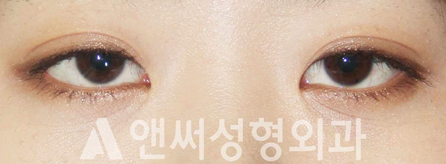 Answer Plastic Surgery case 439: Before