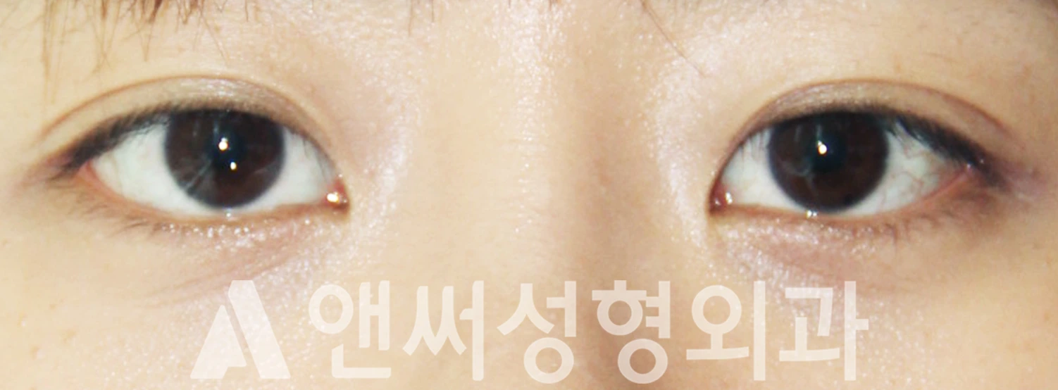 Answer Plastic Surgery case 439: After