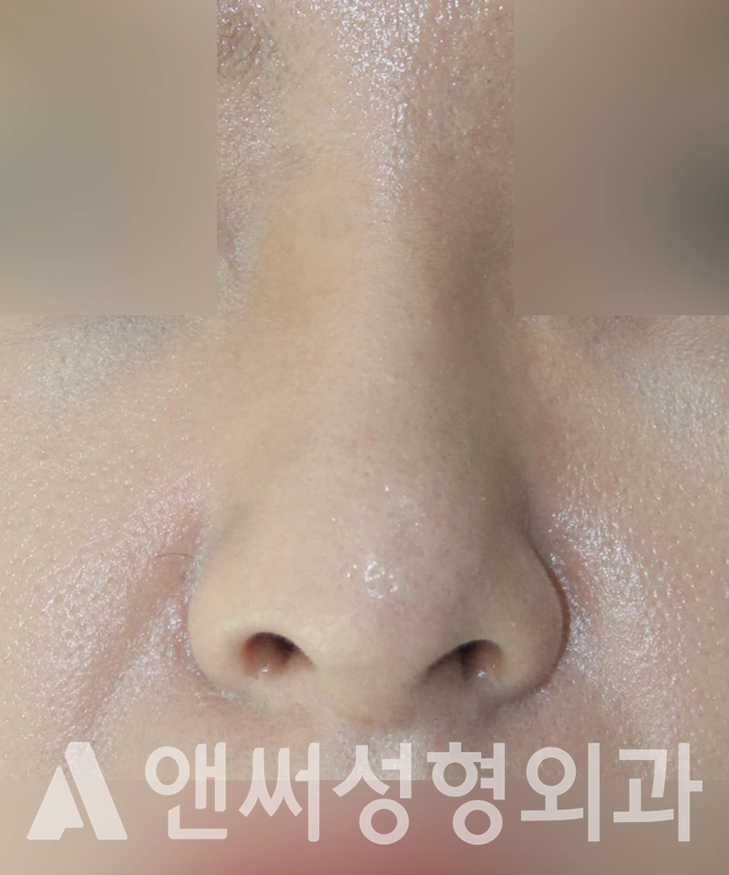 Answer Plastic Surgery case 431: Before