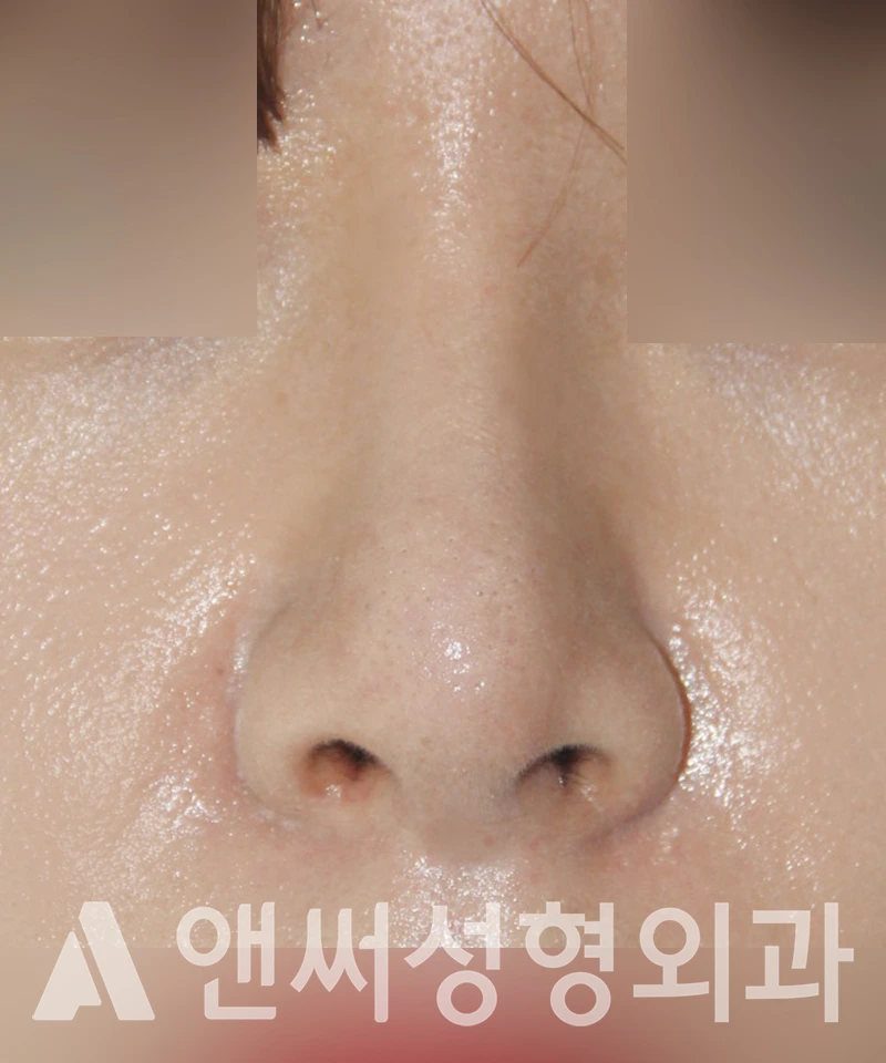 Answer Plastic Surgery case 431: After
