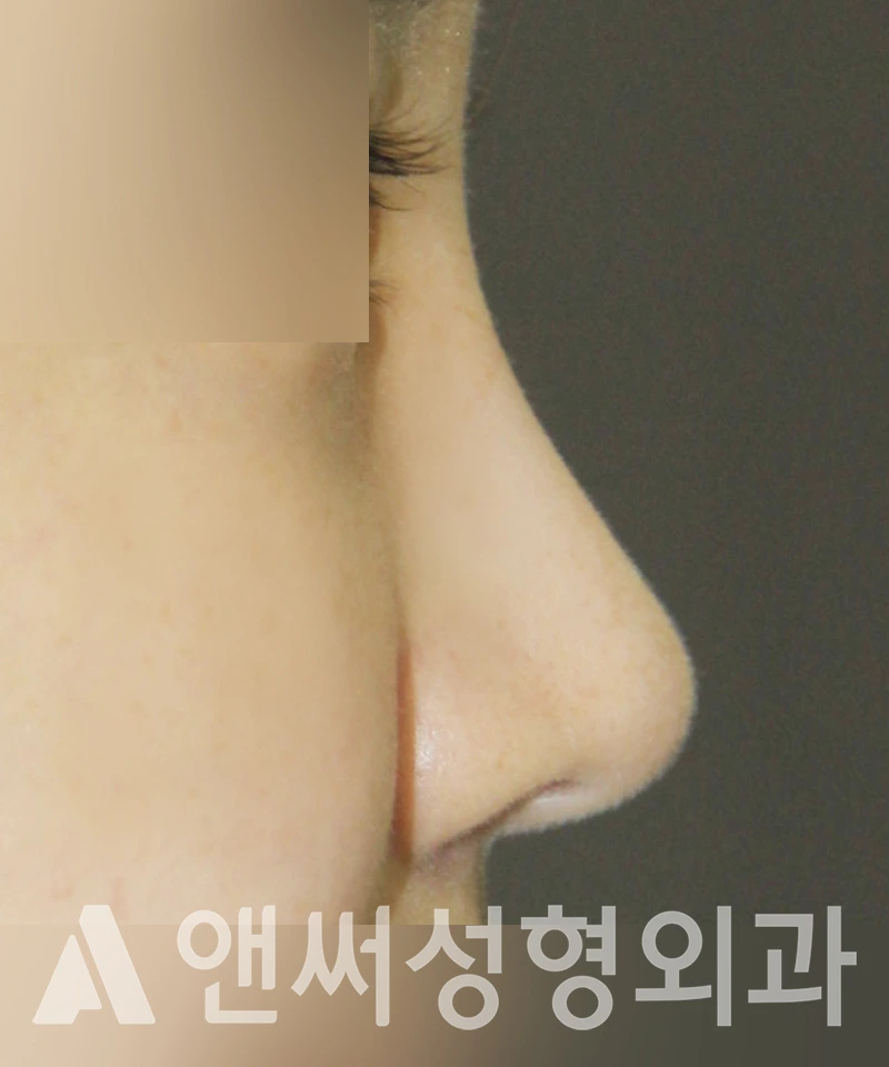 Answer Plastic Surgery case 430: After