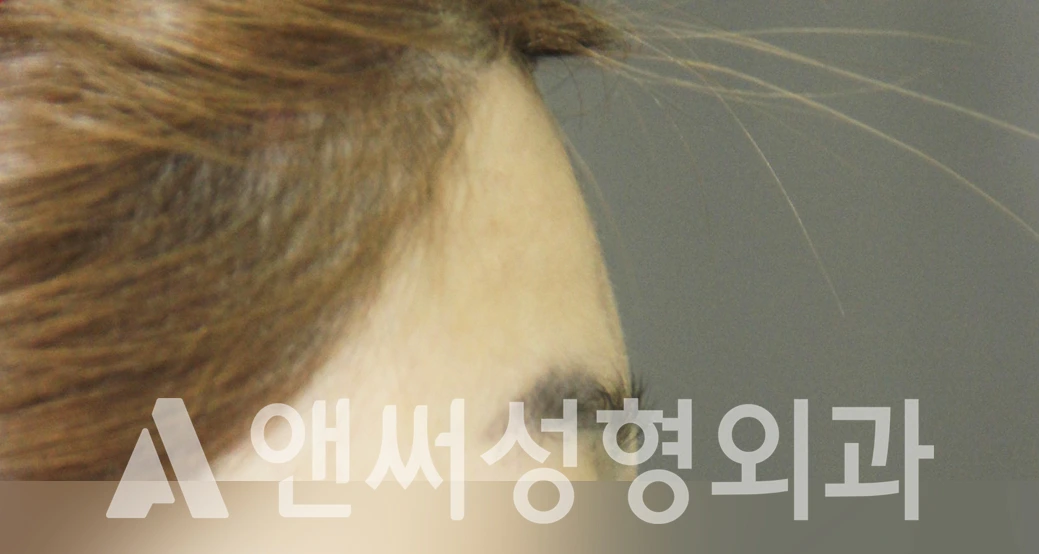 Answer Plastic Surgery case 429: Before