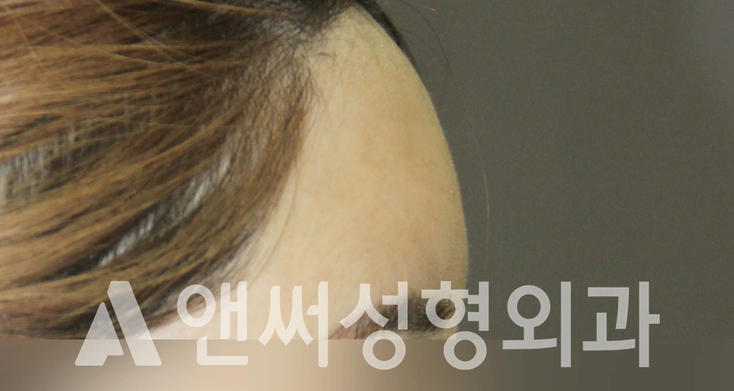 Answer Plastic Surgery case 429: After