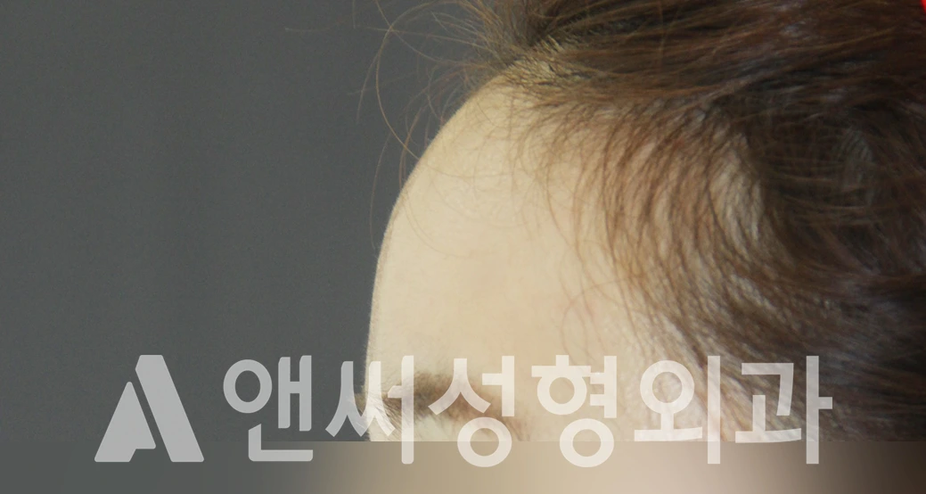 Answer Plastic Surgery case 427: After