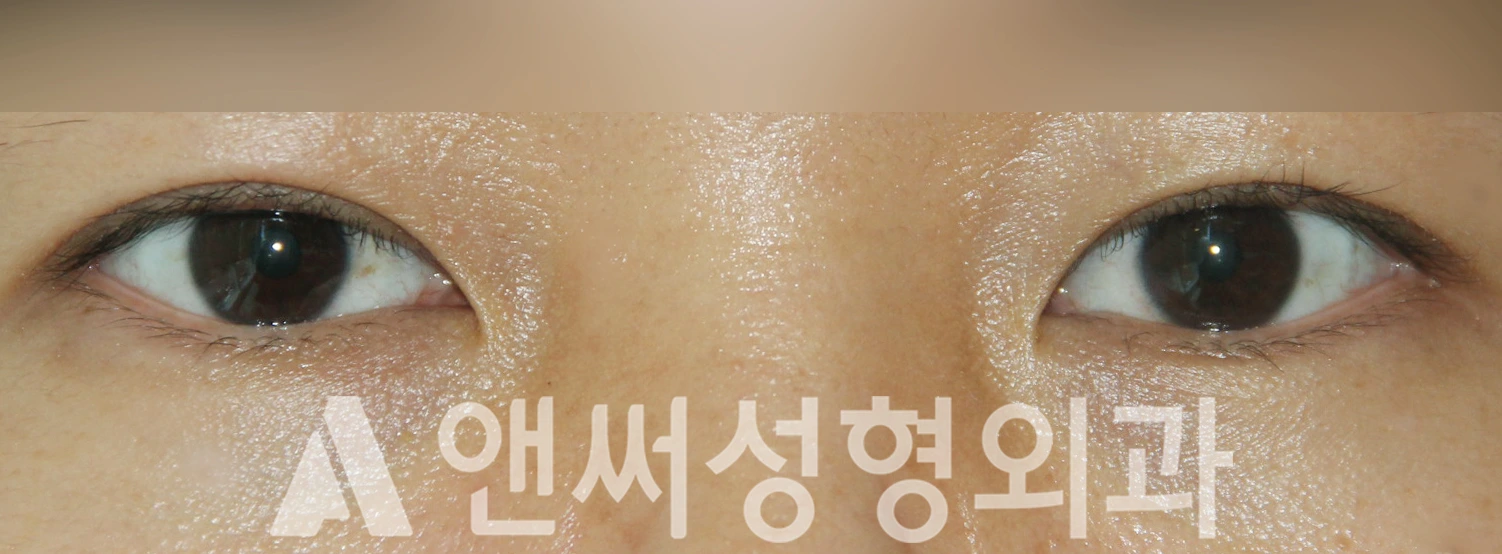 Answer Plastic Surgery case 425: After