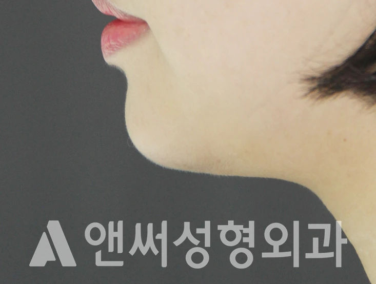 Answer Plastic Surgery case 422: After