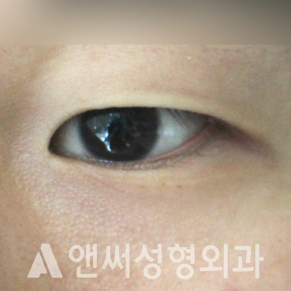 Answer Plastic Surgery case 421: Before