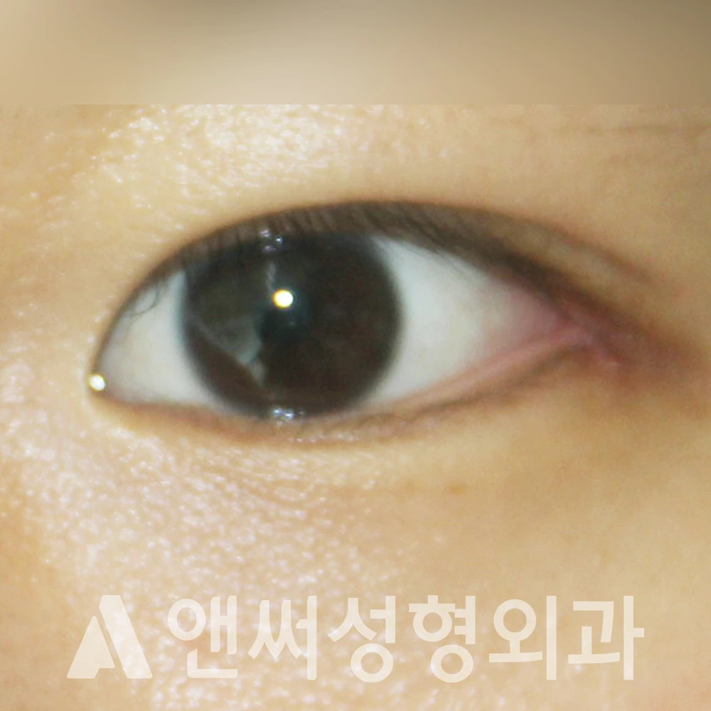 Answer Plastic Surgery case 421: After