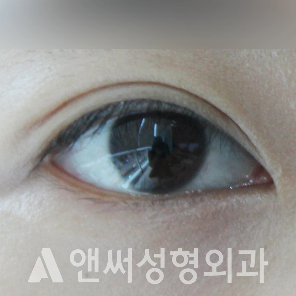 Answer Plastic Surgery case 419: After