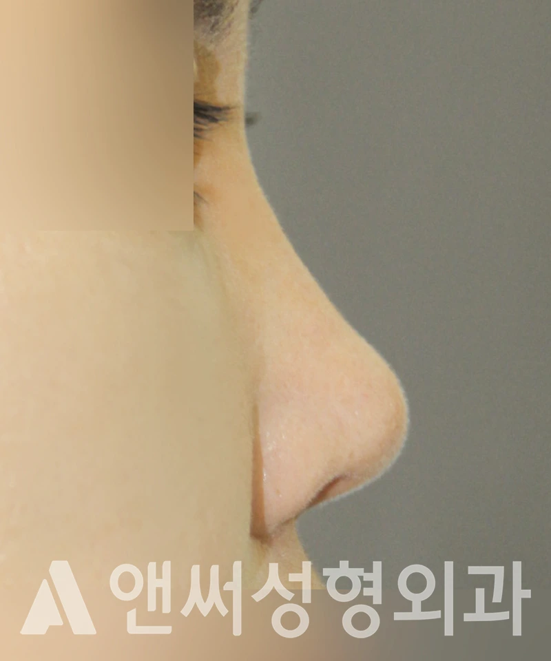 Answer Plastic Surgery case 417: After
