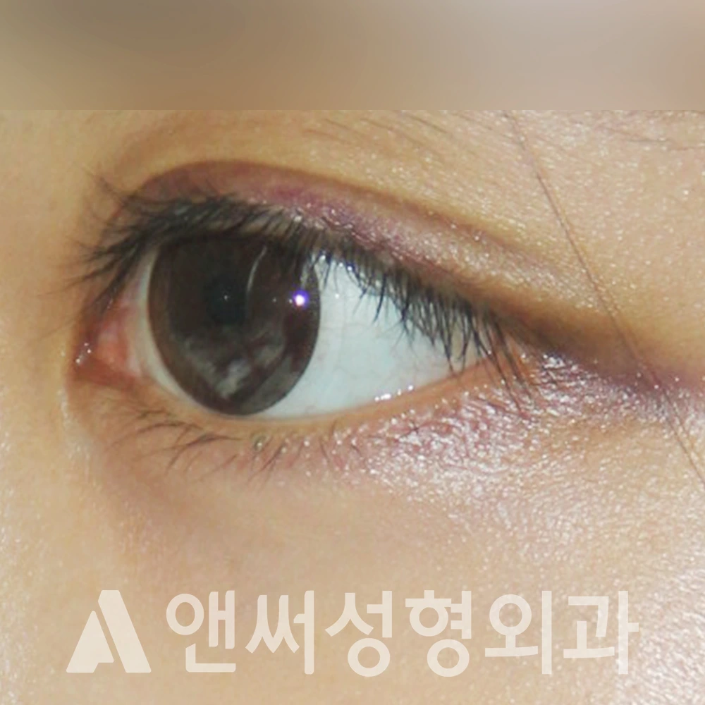 Answer Plastic Surgery case 416: After