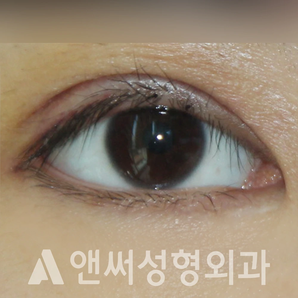 Answer Plastic Surgery case 413: After