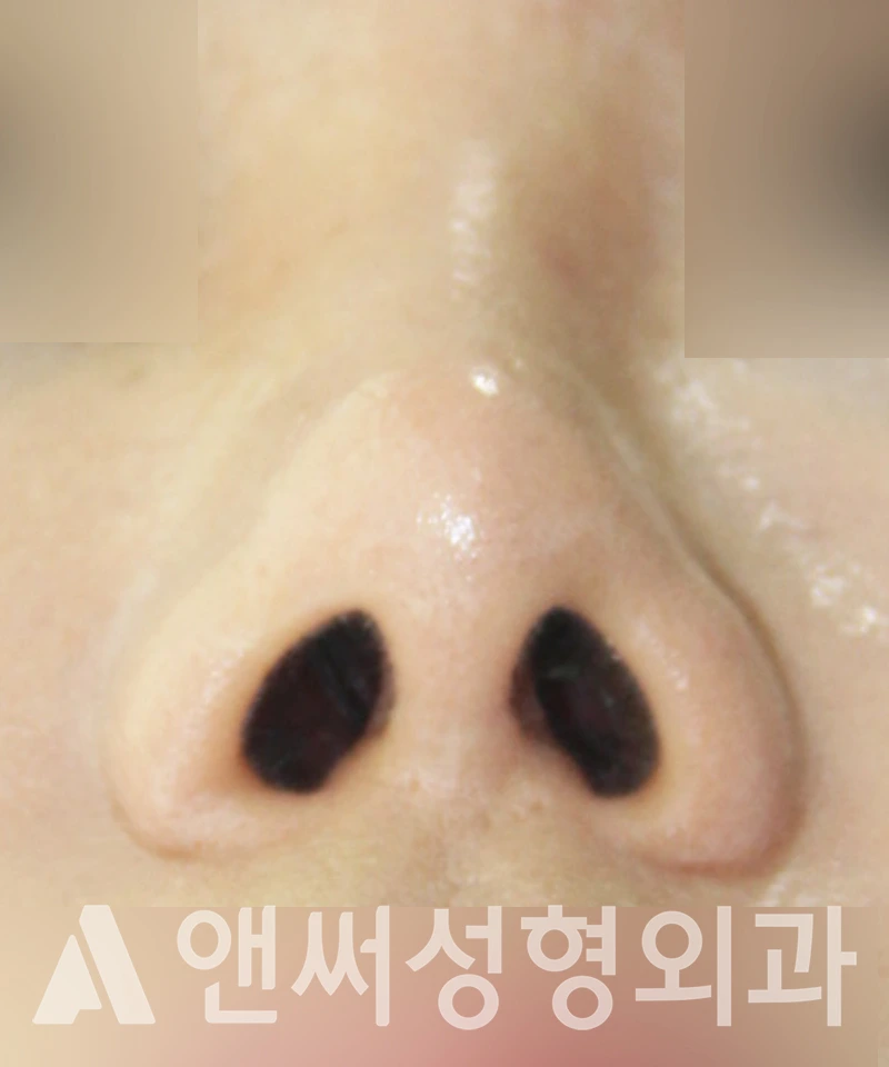 Answer Plastic Surgery case 412: After
