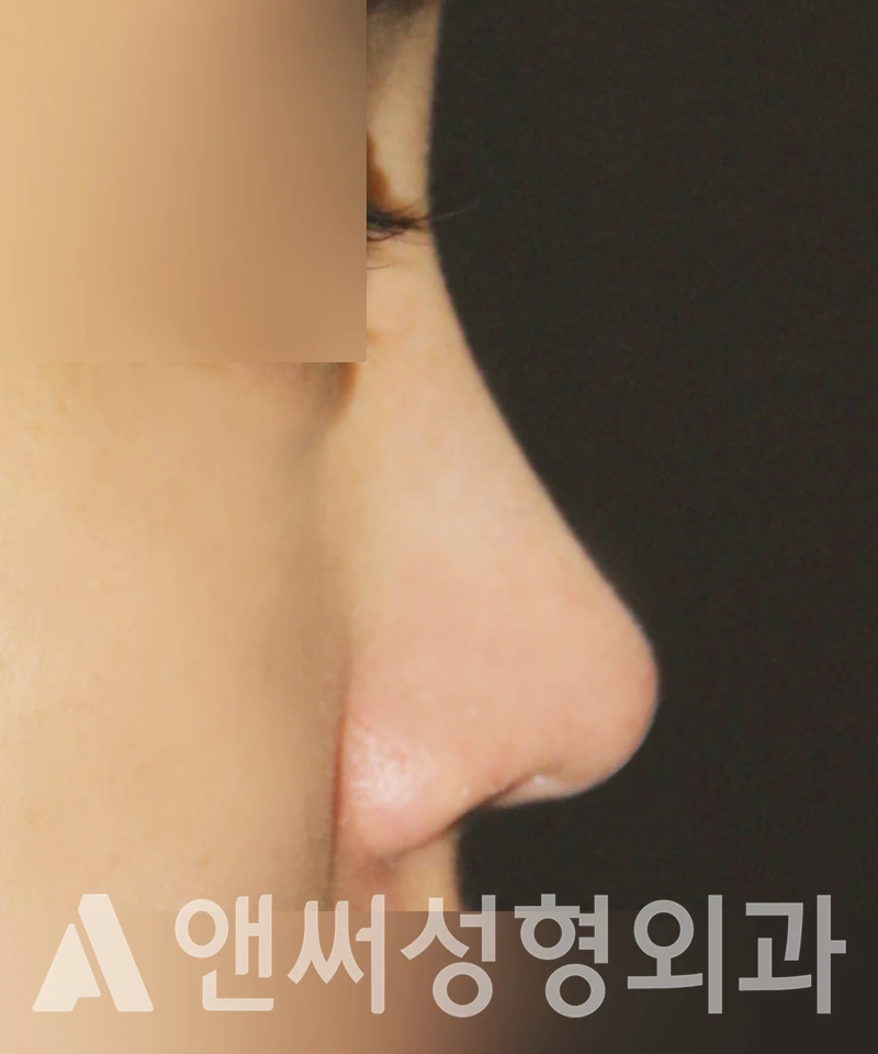 Answer Plastic Surgery case 410: After