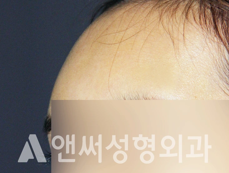 Answer Plastic Surgery case 409: After