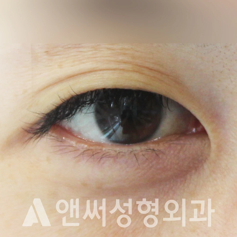 Answer Plastic Surgery case 408: Before